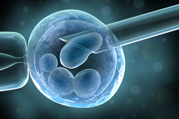 Artificial insemination performed through the intrauterine insemination process to improve chances of conception.
